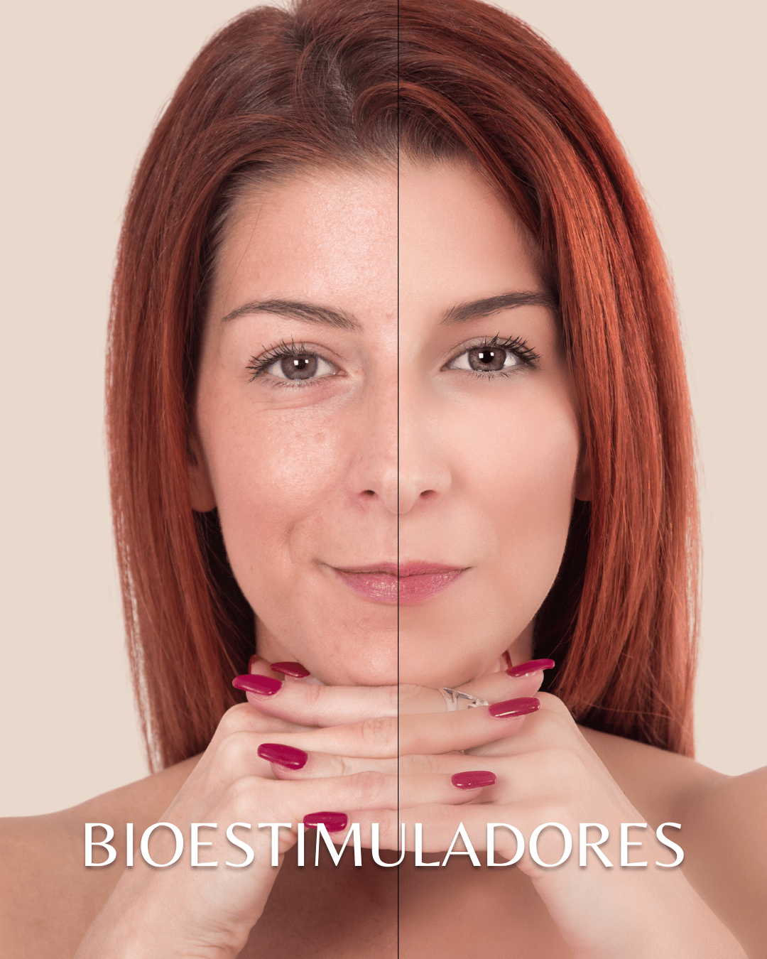 Bioestimuladores
