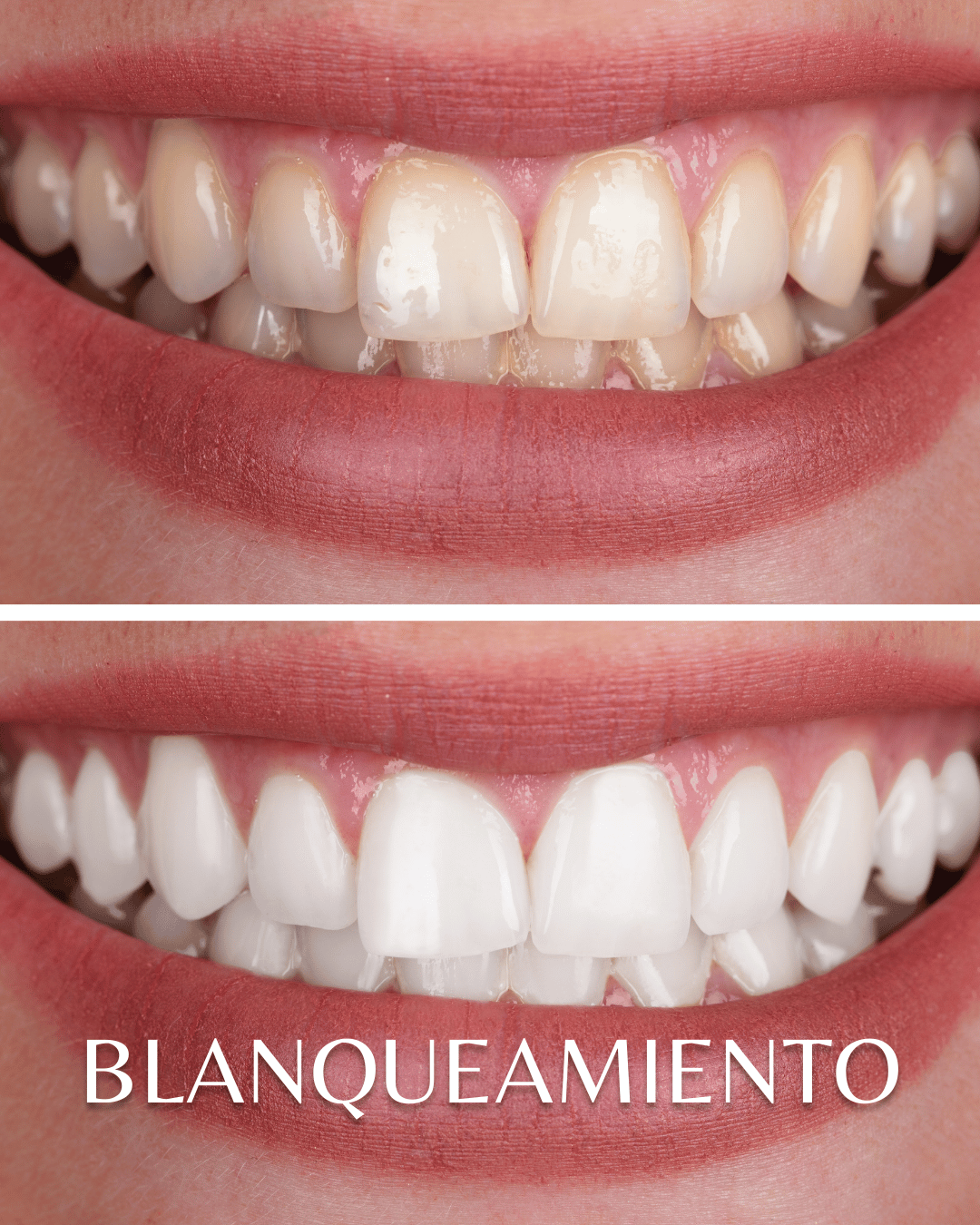 Blanqueamientoales
