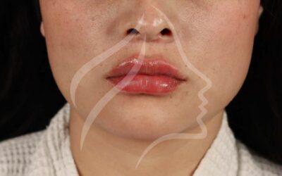 Skinbooster